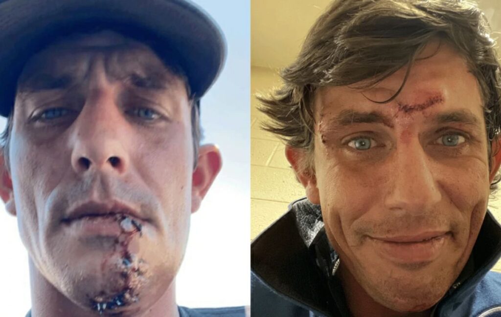 JB Mauney Net Worth 2025 – Bull riding injuries and comeback journey